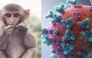 علائم آبله میمون چیست ؟