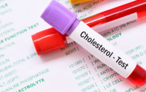 علائم کلسترول خون بالا  چیست؟/ روش های درمان کلسترول خون بالا چیست؟